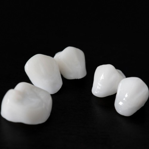 All ceramic dental restorations prior to placement