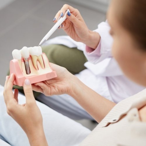 Dentist showing dental patient dental implant model