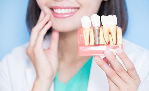 Dentist holding sample implant and touching her jaw