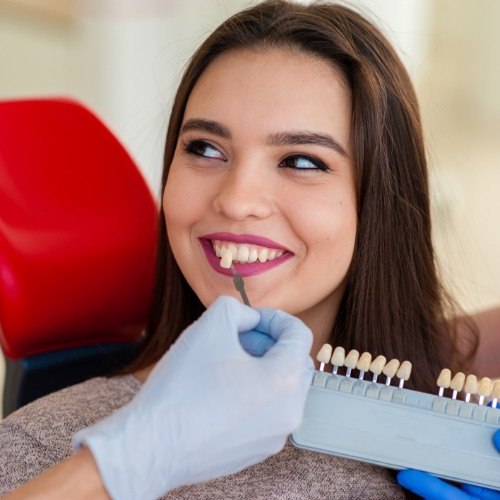 Woman's smile compared with veneers color chart