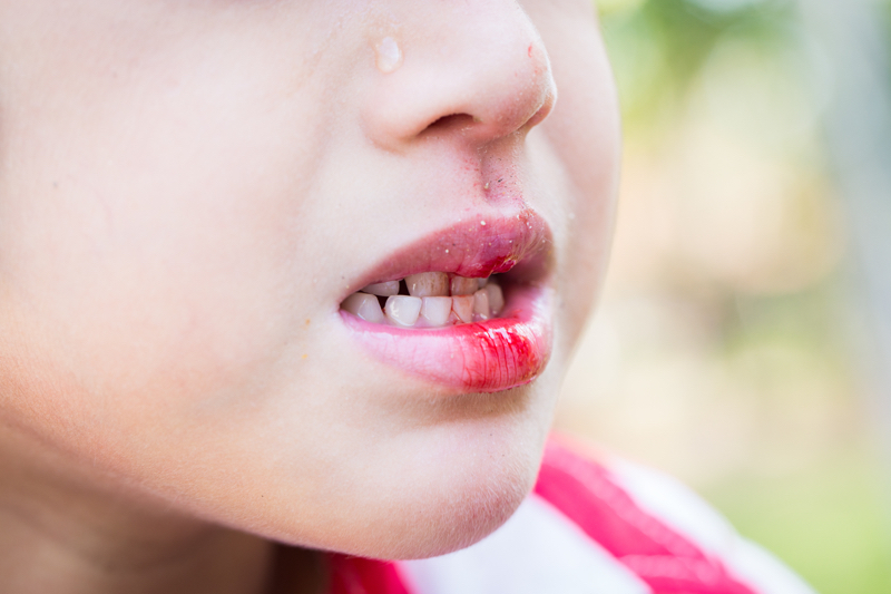 child with dental emergency