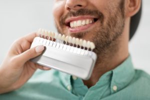 Man with veneers 