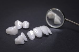 Models of dental bridges at dentist in Columbia.