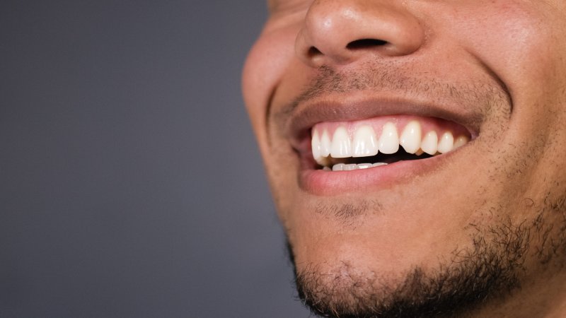 Man showing off healthy gums