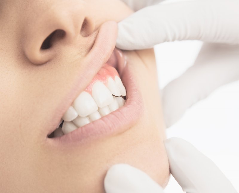 Columbia patient having gums checked by dentist