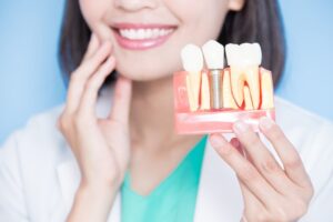 dentist holding a model of a dental implant