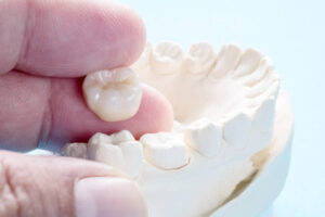 Dental crown next to dental mold